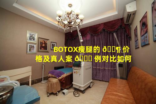 BOTOX瘦腿的 🐶 价格及真人案 🐋 例对比如何